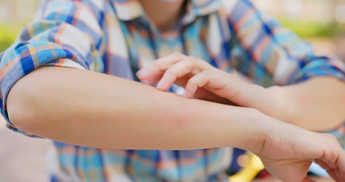 residential-mosquitoes image Say Goodbye to Swarming Mosquitoes